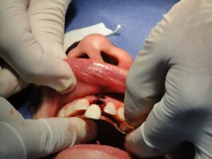tooth